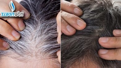 Gray Hair