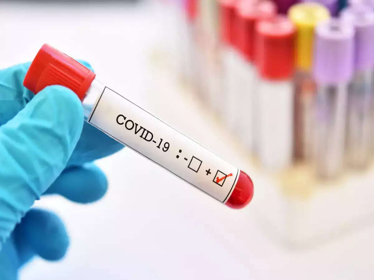 Corona 2021: बीते साल उस अप्रैल की रूह कंपाने वाली याद... 1 Corona 2021