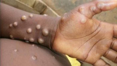 monkey pox 1 मंकीपॉक्स पहुंचा यूपी? शाहजहांपुर में मिला संदिग्ध मरीज, चार दिन तक आया बुखार, फिर बच्चे के शरीर में पड़े फफोले