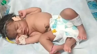 ezgif.com gif maker 1 3 Gwalior News : 4 पैरों वाली 'अनोखी' बच्ची ने लिया जन्म, अस्पताल में उमड़ रही भीड़