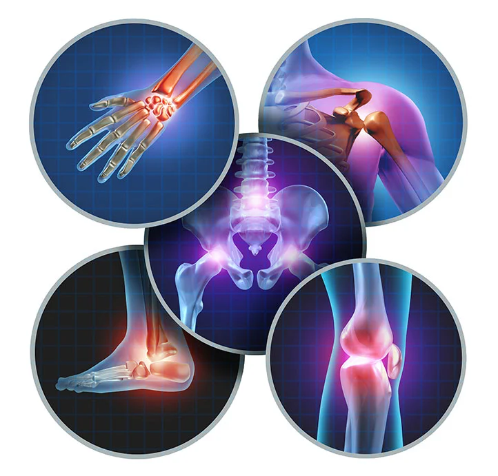 Joint Pain