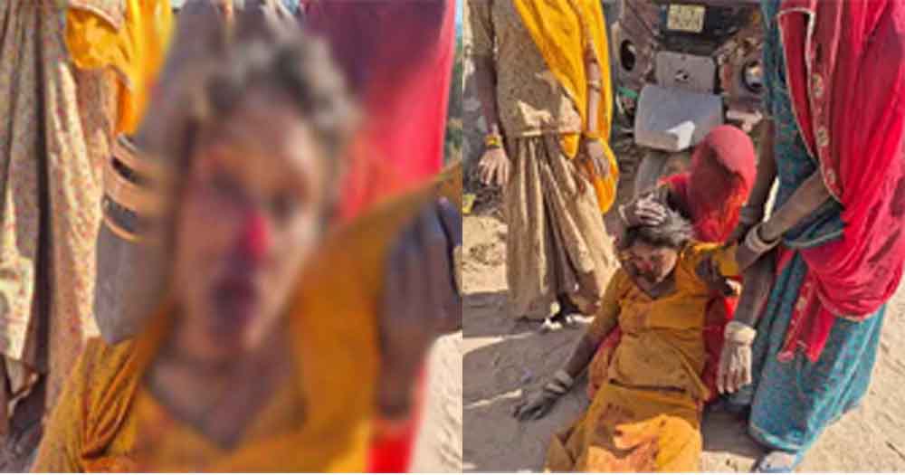 राजस्थान-जालौर में भतीजे ने चाकू से बुआ की नाक काटी, जमीन विवाद में पर हमले में महिला गंभीर घायल 1 Rajasthan 11 1 3 राजस्थान-जालौर में भतीजे ने चाकू से बुआ की नाक काटी, जमीन विवाद में पर हमले में महिला गंभीर घायल