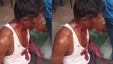24A 9 MP News: झाड़ियों में छुपे बाघ ने बकरी चराने वाले पर पीछे से किया हमला