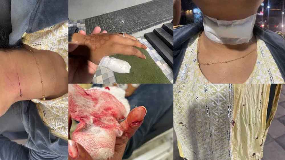 छत्तीसगढ़-रायपुर में पिता के साथ पार्क घूमने जा रहे बच्चे का चाइनीज मांझे से गला कटा, इलाज के दौरान मौत 1 Cg 10 1 11 छत्तीसगढ़-रायपुर में पिता के साथ पार्क घूमने जा रहे बच्चे का चाइनीज मांझे से गला कटा, इलाज के दौरान मौत