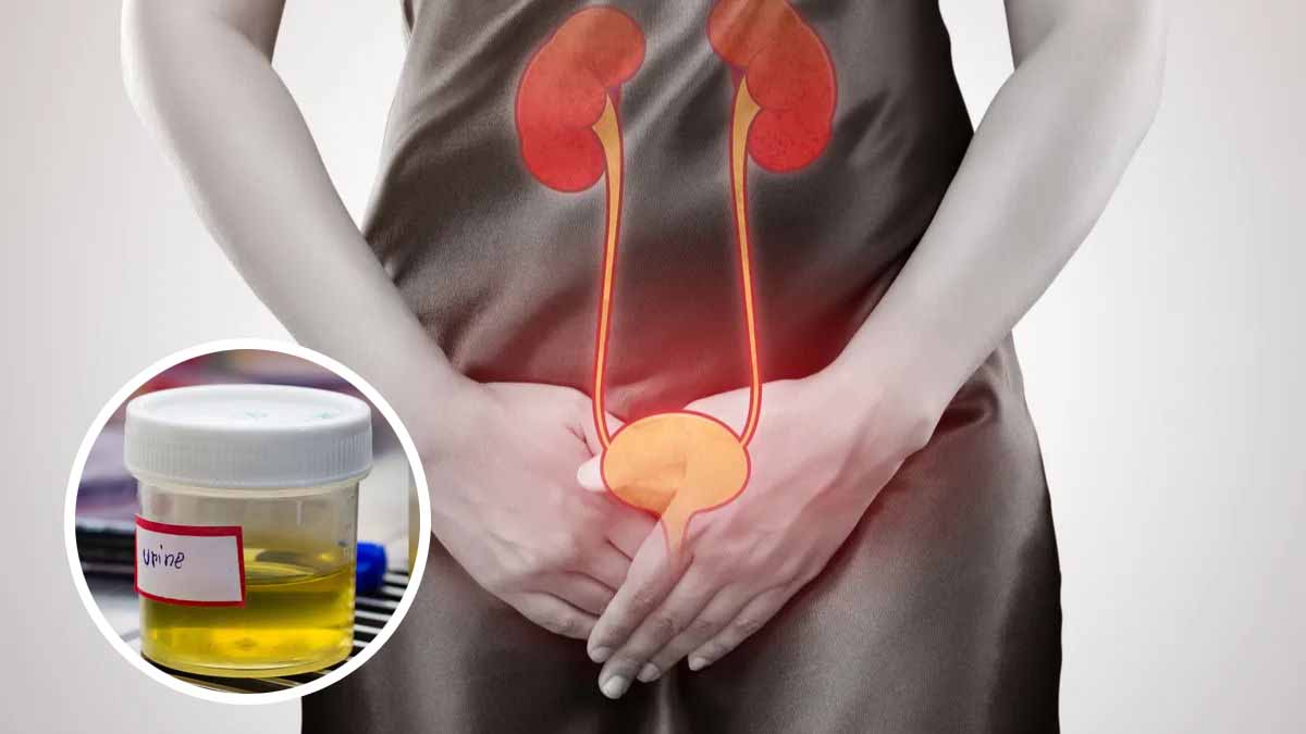Health Tips: पेशाब में तेज बदबू को नजरअंदाज न करें, हो सकती हैं ये 5 गंभीर बीमारियां 1 Health Tips For Urine