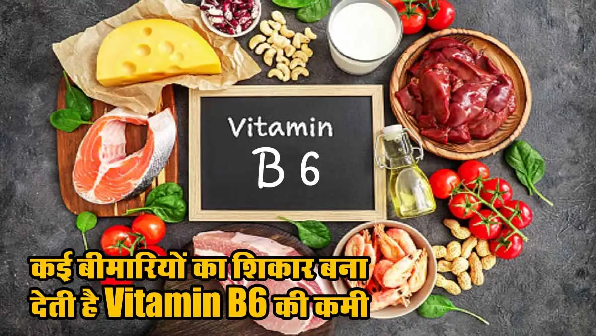 Health Tips: कई बीमारियों का शिकार बना देती है Vitamin B6 की कमी 1 Vitamin B6