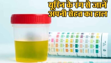 Urine colour