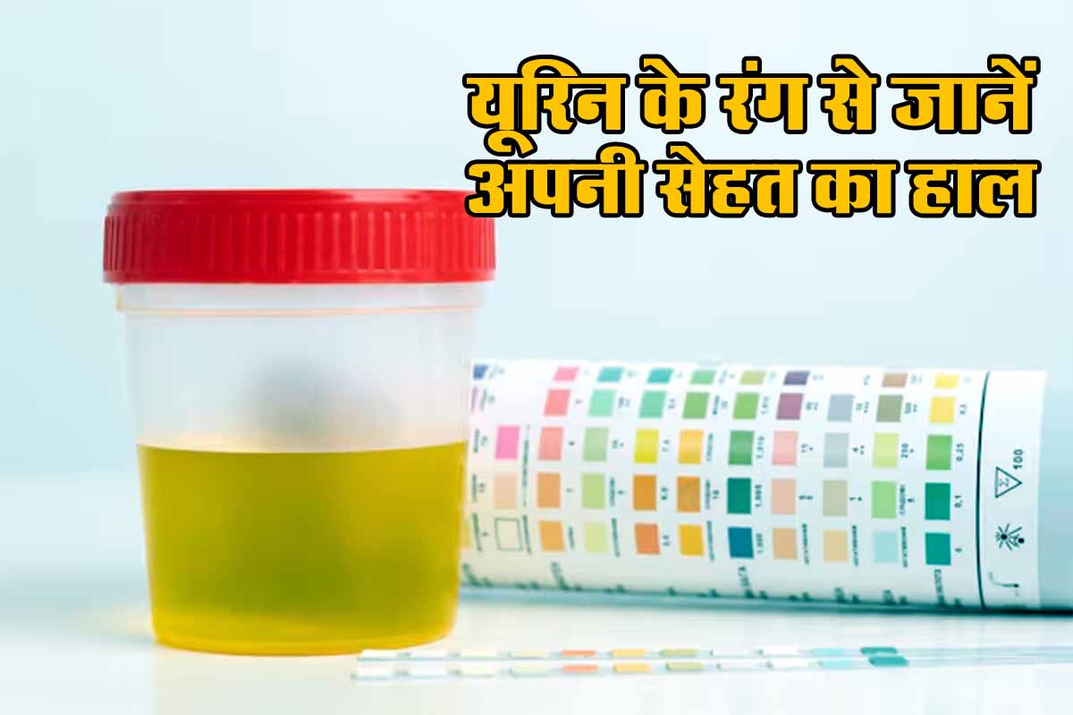 Health Tips: यूरिन के रंग से जानें अपनी सेहत का हाल: गुलाबी, भूरा, पीला या लाल, कौन सा संकेत खतरनाक? 1 Urine colour